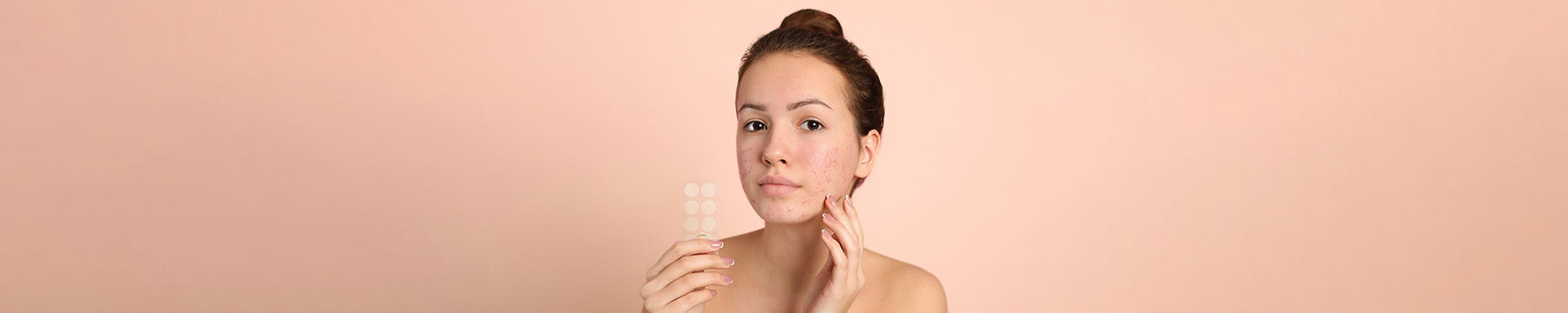 How Do Pimple Patches Work?