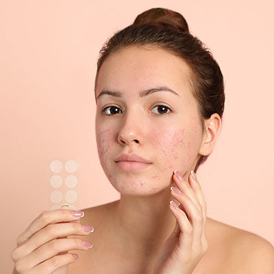 How Do Pimple Patches Work?
