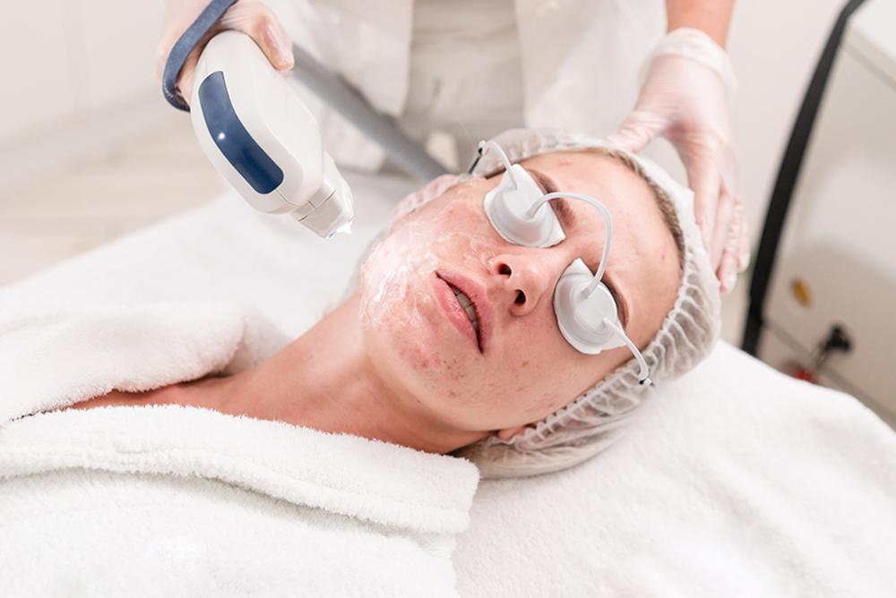 tipos de tratamiento láser facial